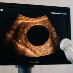Volumetric Ultrasound Ovulation Diagnostics: Disruptive Growth & Breakthroughs Revealed for 2025–2030